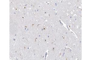 Immunohistochemistry (IHC) image for anti-Aryl Hydrocarbon Receptor (AHR) (pSer36) antibody (ABIN6256291)