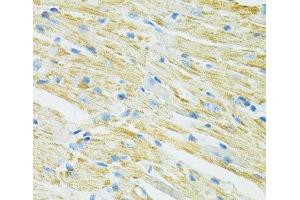 Immunohistochemistry of paraffin-embedded Mouse heart using SLC19A1 Polyclonal Antibody at dilution of 1:100 (40x lens). (SLC19A1 抗体)