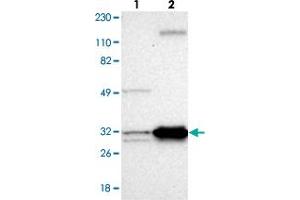 Western blot analysis of Lane 1: Human cell line RT-4, Lane 2: Human cell line U-251MG sp with ECH1 polyclonal antibody . (ECH1 抗体)