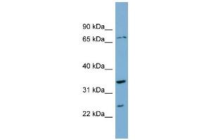 WB Suggested Anti-PDP2 Antibody Titration: 0. (PDP2 抗体  (Middle Region))