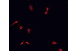 ABIN6266799 staining K562  cells by IF/ICC. (TACC1 抗体  (N-Term))