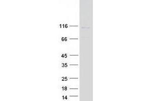 Western Blotting (WB) image for Ubiquitin Specific Peptidase 33 (USP33) (Transcript Variant 2) protein (Myc-DYKDDDDK Tag) (ABIN2735106)