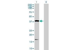 Lane 1: OXA1L transfected lysate ( 48.