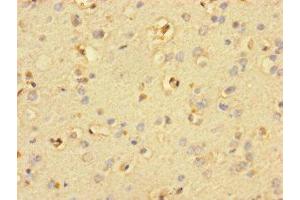 Immunohistochemistry of paraffin-embedded human brain tissue using ABIN7169856 at dilution of 1:100