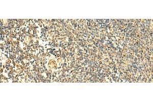 Immunohistochemistry (Paraffin-embedded Sections) (IHC (p)) image for anti-ATP Synthase, H+ Transporting, Mitochondrial Fo Complex, Subunit D (ATP5H) antibody (ABIN7246976)