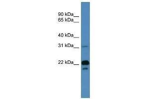 BASP1 antibody used at 0.