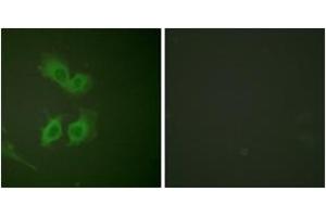 Immunofluorescence analysis of HeLa cells, using Amyloid beta A4 (Ab-743/668) Antibody. (APP 抗体  (AA 711-760))