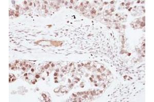 Image no. 1 for anti-Zinc Finger Protein 501 (ZNF501) (AA 67-271) antibody (ABIN1501846) (ZNF501 抗体  (AA 67-271))