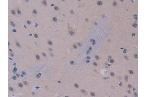 Immunohistochemistry (IHC) image for anti-Interleukin 12 alpha (IL12A) (AA 23-215) antibody (ABIN7430654)