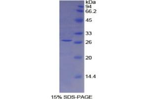 SDS-PAGE analysis of Mouse TFPI2 Protein. (TFPI2 蛋白)