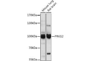 Western blot analysis of extracts of various cell lines, using PRKG2 Rabbit pAb (ABIN7269664) at 1:1000 dilution.