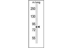 anti-Leucine Rich Repeat and Sterile alpha Motif Containing 1 (LRSAM1) (AA 1-30), (N-Term) antibody