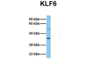 Host:  Rabbit  Target Name:  KLF6  Sample Tissue:  Human Fetal Liver  Antibody Dilution:  1. (KLF6 抗体  (N-Term))