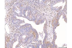 IHC analysis of ENPP1/PC1 using anti-ENPP1/PC1 antibody (ABIN7601410).