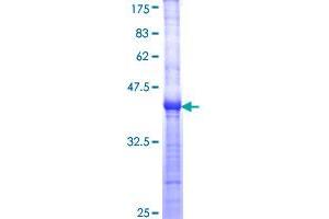 Image no. 1 for Werner syndrome RecQ like helicase (WRN) (AA 1322-1432) protein (GST tag) (ABIN1325380)