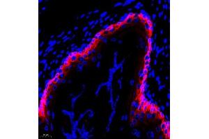 Immunofluorescent analysis of paraffin embedded rat stomcah using CK6 (ABIN7074423) at dilution of 1: 2000 (Keratin 6 抗体)