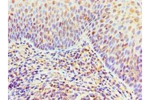 Immunohistochemistry of paraffin-embedded human tonsil tissue using ABIN7156454 at dilution of 1:100 (ITGA9 抗体  (AA 30-250))