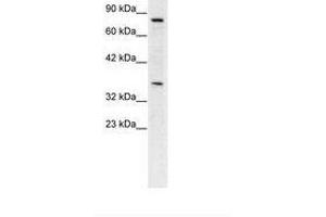 NPAS1 antibody  (C-Term)
