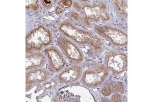 Immunohistochemical staining of human kidney shows moderate cytoplasmic and membranous positivity in cells in tubules. (IL1R1 抗体)
