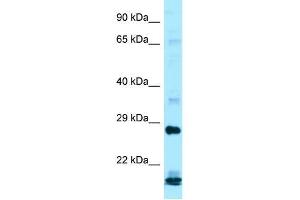 Western Blotting (WB) image for anti-Interferon, alpha 16 (IFNA16) (C-Term) antibody (ABIN2788554) (IFNA16 抗体  (C-Term))