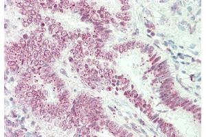 Rabbit Anti-ST6GALNAC1 antibody  Formalin Fixed Paraffin Embedded Tissue: Human Uterus Primary antibody Concentration: 1:100 Secondary Antibody: Donkey anti-Rabbit-Cy3 Secondary Antibody Concentration: 1:200 Magnification: 20x Exposure Time: 0. (ST6GALNAC1 抗体  (Middle Region))