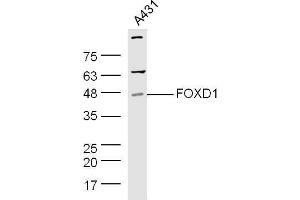 Human A431 cell lysates probed with Rabbit Anti-Pan FOXD Polyclonal Antibody, Unconjugated  at 1:500 for 90 min at 37˚C. (FOXD (AA 131-230) 抗体)