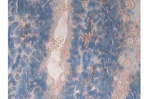 Immunohistochemistry (IHC) image for anti-Growth Hormone Receptor (GHR) (AA 353-588) antibody (ABIN7442081)