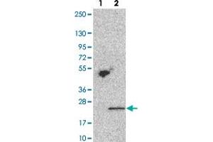 Western blot analysis of Lane 1: Negative control (vector only transfected HEK293T lysate). (TMEM69 抗体)