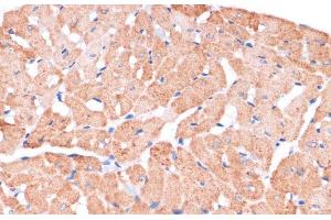 Immunohistochemistry of paraffin-embedded Rat heart using DVL2 Polyclonal Antibody at dilution of 1:100 (40x lens). (DVL2 抗体)