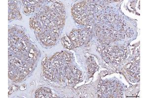 IHC analysis of Pleckstrin/PLEK using anti-Pleckstrin/PLEK antibody (ABIN7601814).