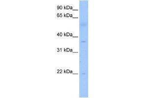 RG9MTD3 antibody used at 1 ug/ml to detect target protein. (RG9MTD3 抗体)