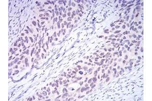 Immunohistochemistry (IHC) image for anti-DNA (Cytosine-5-)-Methyltransferase 3 alpha (DNMT3A) (AA 46-180) antibody (ABIN5542516)