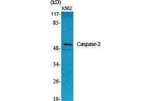 Western Blot (WB) analysis of specific cells using Caspase-2 Polyclonal Antibody. (Caspase 2 抗体  (Ser197))