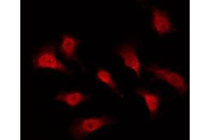 ABIN6276016 staining Hela by IF/ICC. (GPR153 抗体  (Internal Region))