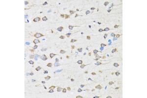Immunohistochemistry of paraffin-embedded rat brain using COPB2 antibody (ABIN5974232) at dilution of 1/100 (40x lens). (COPB2 抗体)