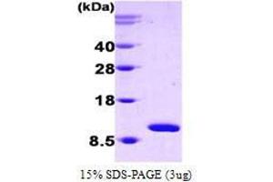 Figure annotation denotes ug of protein loaded and % gel used. (HSPE1 Protein (AA 1-102))