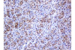 Image no. 1 for anti-Galactosidase, beta 1 (GLB1) antibody (ABIN1498467) (GLB1 抗体)