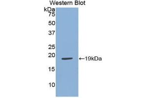 Western blot analysis of the recombinant protein. (Adrenomedullin 抗体  (AA 31-187))