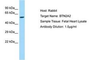 Image no. 1 for anti-butyrophilin, Subfamily 2, Member A2 (BTN2A2) (AA 64-113) antibody (ABIN6750158) (BTN2A2 抗体  (AA 64-113))