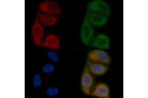 ALG6 Mouse Monoclonal Antibody staining Hela cells by IF/ICC. (ALG6 抗体)