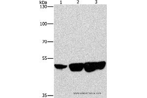 Western blot analysis of Hela, hepG2 and 231 cell, using CTBP2 Polyclonal Antibody at dilution of 1:400 (CTBP2 抗体)