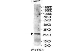WB analysis of SW620 lysates, using CMTM4 antibody. (CMTM4 抗体)