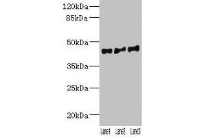 Western blot All lanes: VN1R2 antibody at 2 μg/mL Lane 1: Hela whole cell lysate Lane 2: A549 whole cell lysate Lane 3: HepG2 whole cell lysate Secondary Goat polyclonal to rabbit IgG at 1/10000 dilution Predicted band size: 45 kDa Observed band size: 45 kDa (VN1R2 抗体  (AA 115-170))