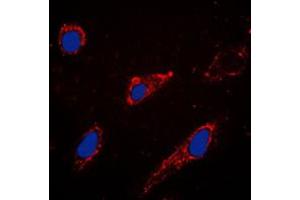 Immunofluorescent analysis of EPAC1 staining in A549 cells. (RAPGEF3 抗体  (C-Term))