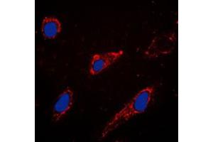 Immunofluorescent analysis of EPAC1 staining in A549 cells.