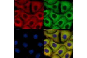 pan Actin Mouse Monoclonal Antibody staining HepG2 cells by IF/ICC. (Actin 抗体  (pan))