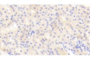 Detection of TNC in Human Kidney Tissue using Polyclonal Antibody to Tenascin C (TNC) (TNC 抗体  (AA 49-181))