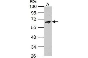 WB Image Sample (30 ug of whole cell lysate) A: U87-MG 10% SDS PAGE antibody diluted at 1:1000 (CAMKK2 抗体  (N-Term))