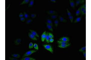 Immunofluorescent analysis of HepG2 cells using ABIN7147586 at dilution of 1:100 and Alexa Fluor 488-congugated AffiniPure Goat Anti-Rabbit IgG(H+L) (CLIC2 抗体  (AA 53-247))