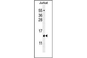 Western blot analysis of H2AFZ Antibody (C-term) in Jurkat cell line lysates (35ug/lane). (H2AFZ 抗体  (C-Term))